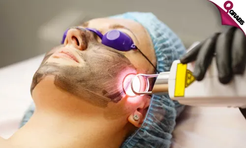 Brighten Up Your Skin with Carbon Peel & Laser Toning Treatments!